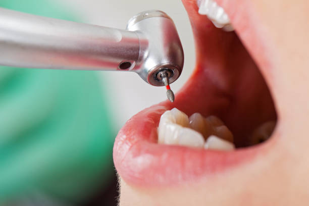 Best Emergency Treatment for Oral Infections in Beacon, NY